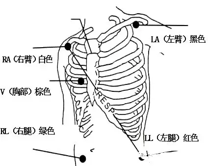 心電監護儀1.jpg